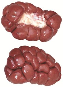 6090 Kidney