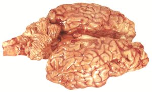6120 Brain